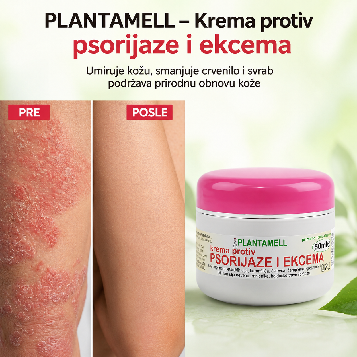 Krema protiv psorijaze i ekcema – Recite zbogom neizdrživom svrabu i ljuspanju kože već nakon prvog nanošenja